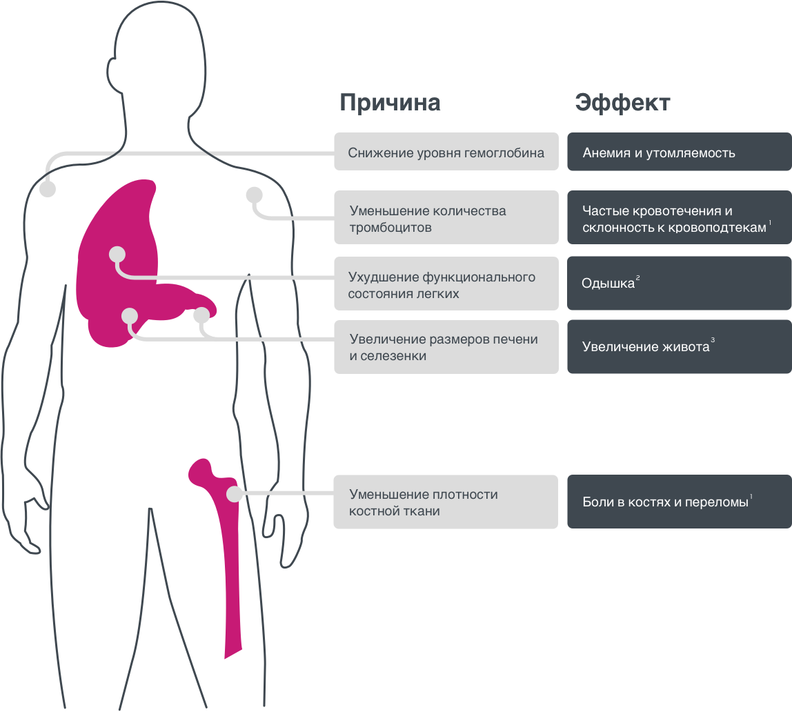Инфографика симптомов болезни Гоше